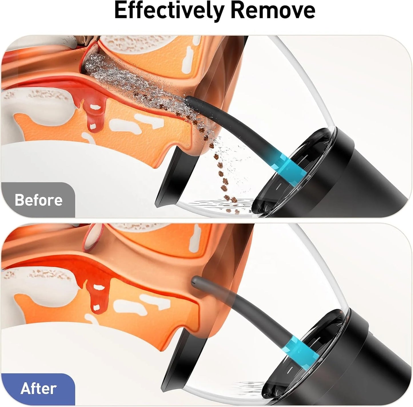 Powerful Rechargeable Earwax Removal with 4 Pressure Modes & IPX6 Waterproof